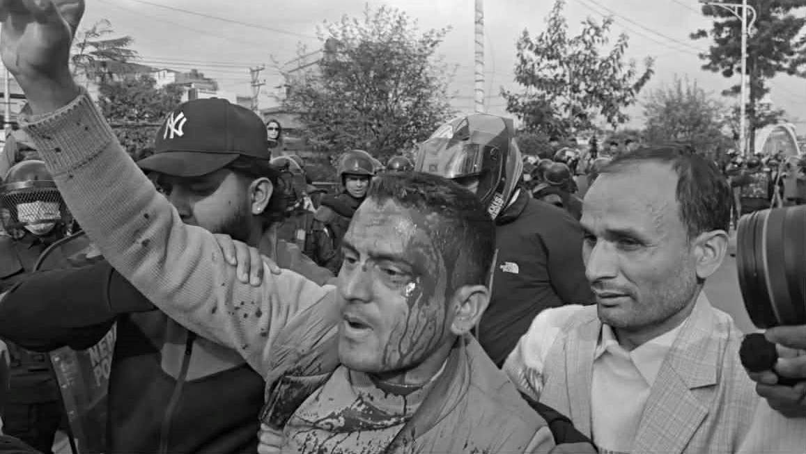 बबरमहलमा एमालेका कार्यकर्ता र प्रहरीबीच झडप